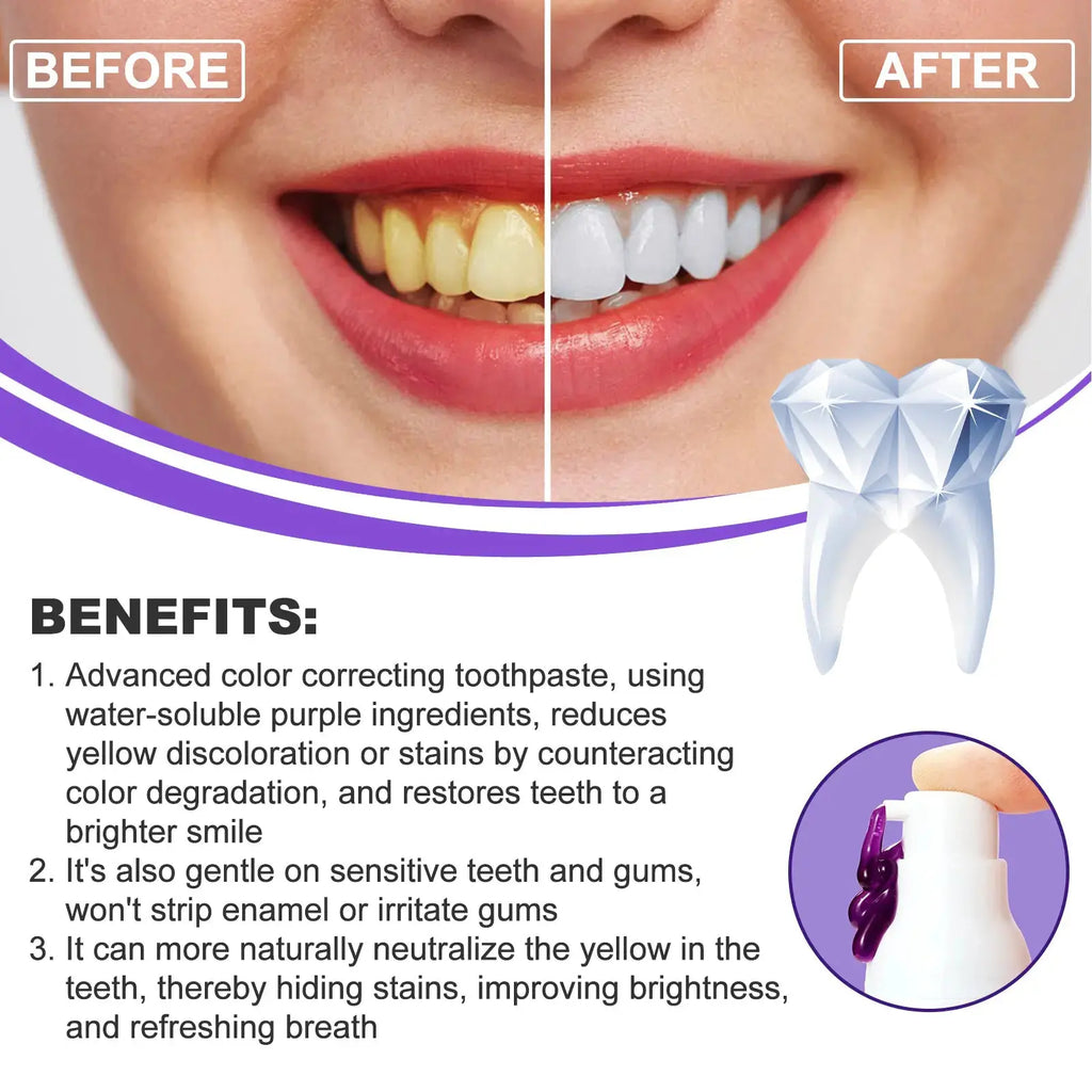 Luminous Lavender Dental Whitener Zopi