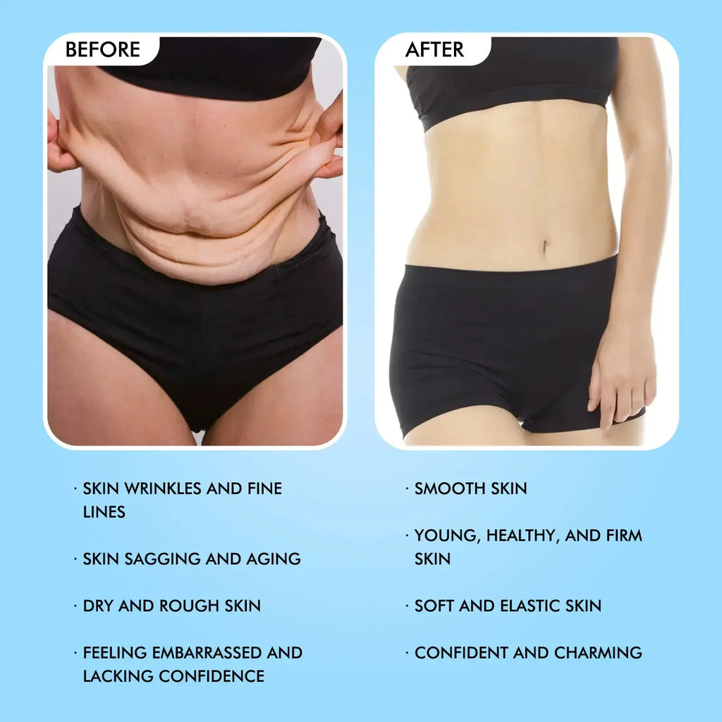 HydraFirm Anti-Aging Body Cream Zopi